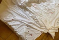 酒店被曝床单有血迹,为什么宾馆床单都有血迹？