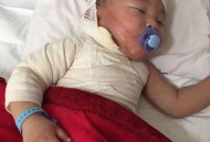 男童被沸水烫伤下肢,被开水烫伤怎么处理？