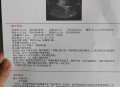 结婚5年未见对方脸,孕期四维检查看不到脸是怎么回事？
