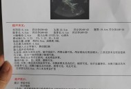 结婚5年未见对方脸,孕期四维检查看不到脸是怎么回事？