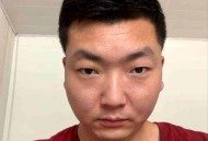 怀疑出轨拔女友8颗牙,
