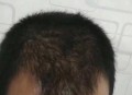 因发量太多剃掉头发,为什么头发剃短了发量少？