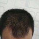 因发量太多剃掉头发,为什么头发剃短了发量少？