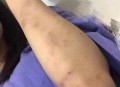 老人摔倒家属投诉,一个女老师对学生拳脚相向，手撕女生的头发，扇脸，把头摔到地上，举报有用吗？