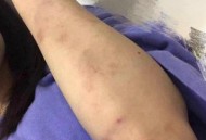 老人摔倒家属投诉,一个女老师对学生拳脚相向，手撕女生的头发，扇脸，把头摔到地上，举报有用吗？
