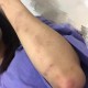老人摔倒家属投诉,一个女老师对学生拳脚相向，手撕女生的头发，扇脸，把头摔到地上，举报有用吗？