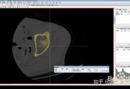 mimics软件教程,mimics软件安装教程