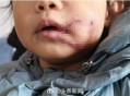 狗闯村民家咬伤女童,村里的狗咬人,应该找谁解决