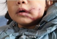 狗闯村民家咬伤女童,村里的狗咬人,应该找谁解决