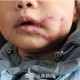 狗闯村民家咬伤女童,村里的狗咬人,应该找谁解决