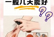 做艾灸致2度烫伤,艾灸烫伤后怎么处理？