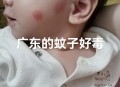 秋蚊子最爱咬5类人,秋天蚊子爱咬什么人