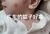 秋蚊子最爱咬5类人,秋天蚊子爱咬什么人