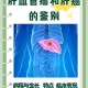 女子孕晚期确诊肝癌,肩膀疼却查出晚期肝癌？其实这2个异常，都可能是肝癌信号,指的是什么？
