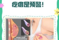 摸到疙瘩确诊乳腺癌,摸着胸部有肿块，是乳腺癌吗？