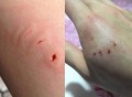 狗闯村民家咬伤女童,如何评价江西省上栗县一名女童被流浪狗咬伤，头部鲜血淋淋？