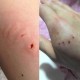 狗闯村民家咬伤女童,如何评价江西省上栗县一名女童被流浪狗咬伤，头部鲜血淋淋？