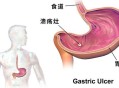 吃羊胎盘染致命细菌,吃羊胎盘染致命细菌吗