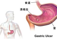 吃羊胎盘染致命细菌,吃羊胎盘染致命细菌吗