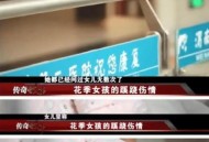 女子遭毒蛇咬伤身亡,蛇真的能把人吃掉吗？
