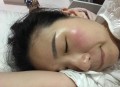结婚5年未见对方脸,为什么脸上的死皮看不见？