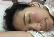 结婚5年未见对方脸,为什么脸上的死皮看不见？