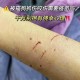 咬破手指写字求救,急急急急急求助猫咪被野猫咬伤怎么处理？