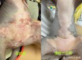 美公园枪击7人受伤,长沙7岁女童公园游玩时被蚊虫“盯上”，长了满腿的丘疹性荨麻疹, 你怎么看？