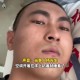 男子吹一夜空调面瘫,男子吹一夜空调面瘫视频