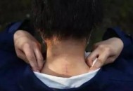 在动物园被老虎咬伤,北京动物园老虎咬死咬伤人女主角又出新招索赔156万，大家怎么看？