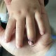 女童指尖被夹断,小孩指尖被夹断