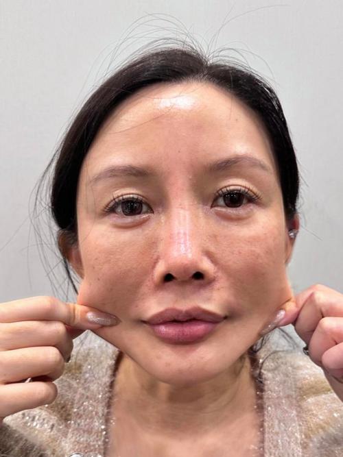 陈意涵医美后脸歪了,明星们有什么延缓衰老的日常习惯是没有自己公开过的呢?