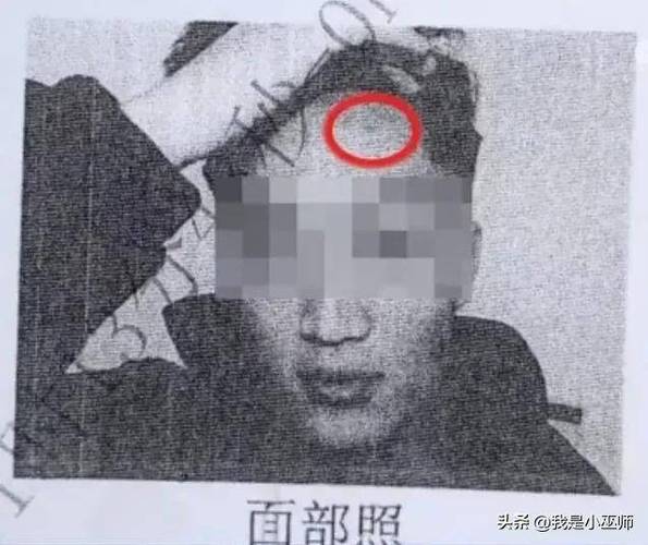 还手即互殴成为历史,对方先动手我还手就叫互殴吗?