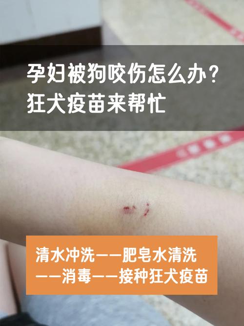 车被狗啃到面目全非,跳蚤咬后奇痒无比,反复发作怎么办?已经被抓的面目全非了?
