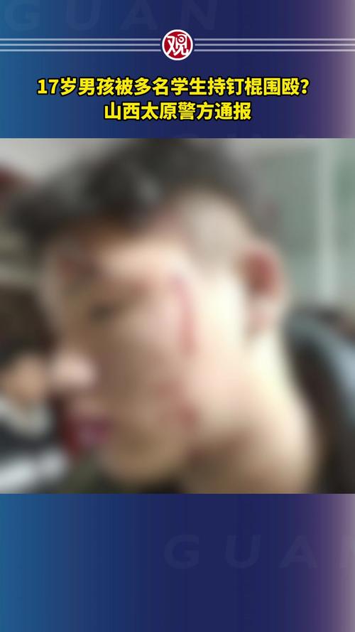 在宿舍内被多人殴打,少年在宿舍遭6人轮流殴打:被逼下跪一声不吭,遇到校园暴力,我们该怎么做?