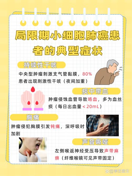 咳嗽不止查出肺癌,咳嗽不止查出肺癌怎么办