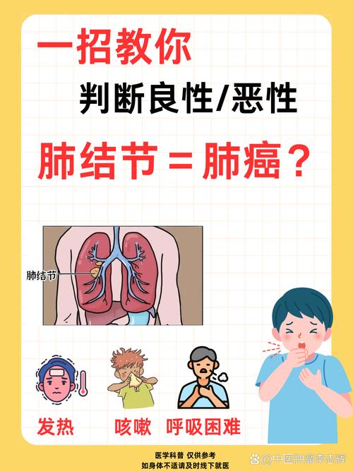 咳嗽不止查出肺癌,咳嗽老是不好会是肺癌吗?