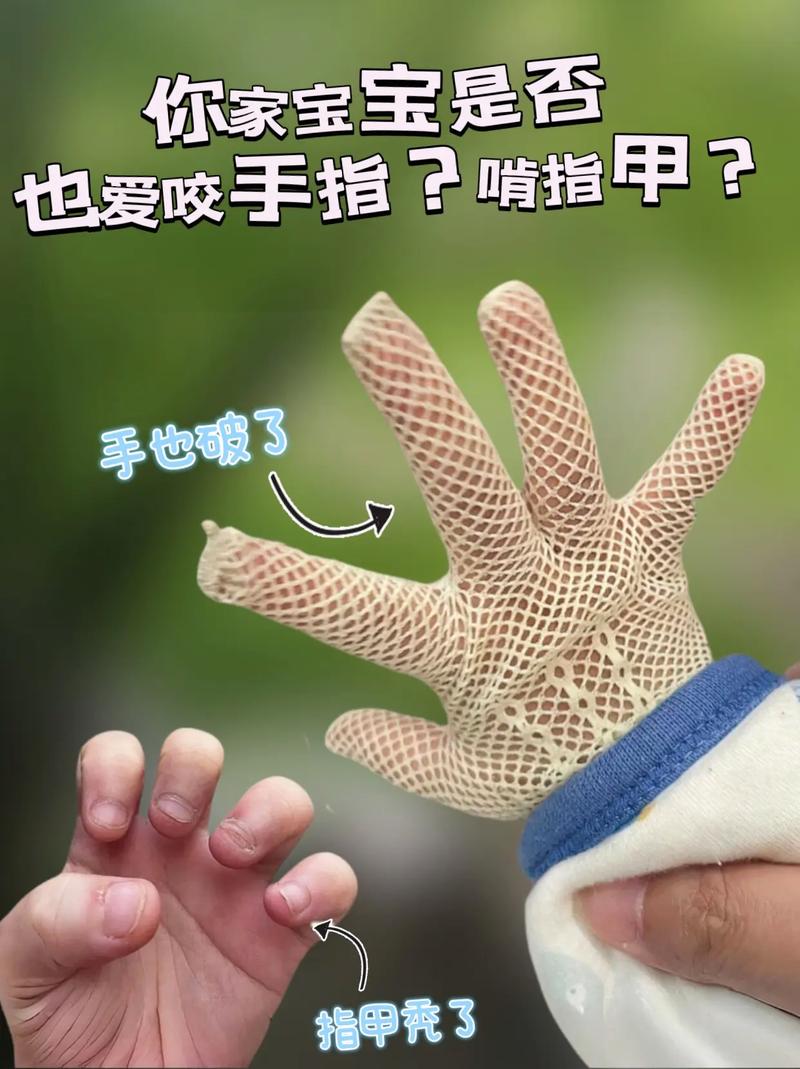 孩子手指被兔子咬掉,孩子手指被兔子咬掉了怎么办