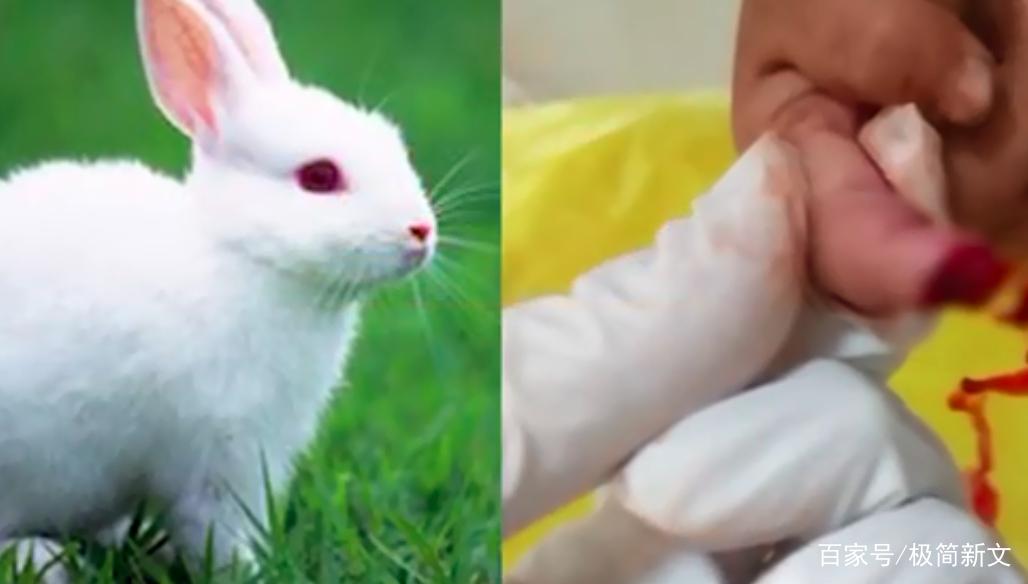 娃喂兔子被咬断手指,娃喂兔子被咬断手指怎么办